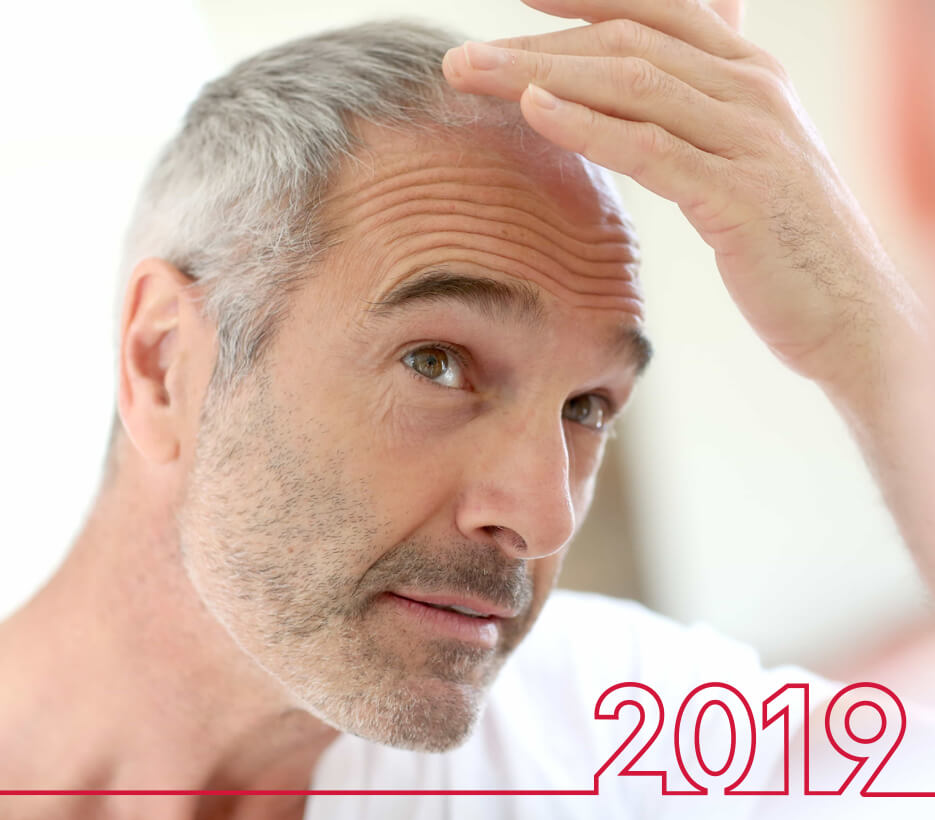 أسعار زراعة الشعر لعام 2019