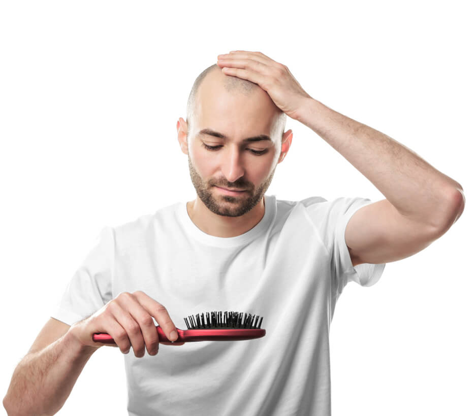 The Technique Which Has Brought Fundamental Changes in Hair Transplant: FUE