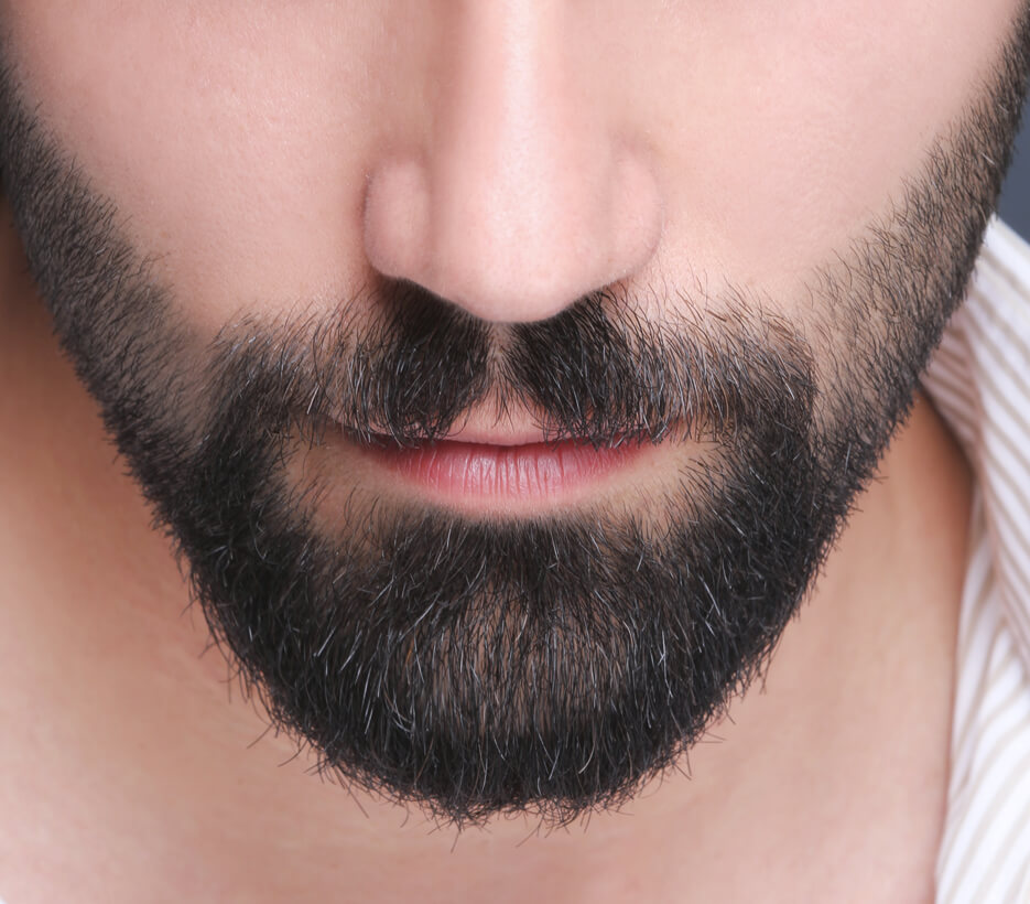 How is Mustache and Beard Transplant Performed?